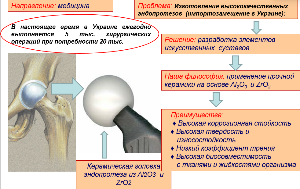 эндопротез локтевой